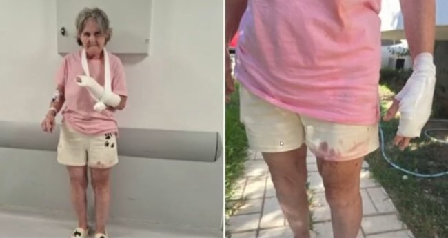 ΕΠΙΘΕΣΗ ΣΚΥΛΩΝ ΒΑΡΗ