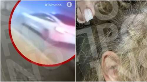 Ανατροπή στην υπόθεση του ξυλοδαρμού 43χρονης από πλαστικό χειρουργό: "Ούρλιαζε, ήταν επιθετική, δεν φαινόταν να έχει χτυπηθεί"