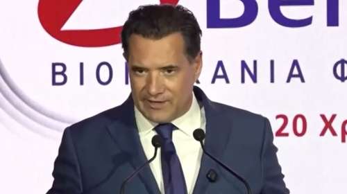 Άδωνις Γεωργιάδης: Εβαλα μαλλιά, έκανα μπότοξ, βάζω κρέμες - Εγώ τα αποκαλύπτω αυτά, δεν κρατώ ιατρικό απόρρητο [βίντεο]