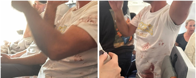 ΝΤΟΥΜΠΑΙ ΠΤΗΣΗ
