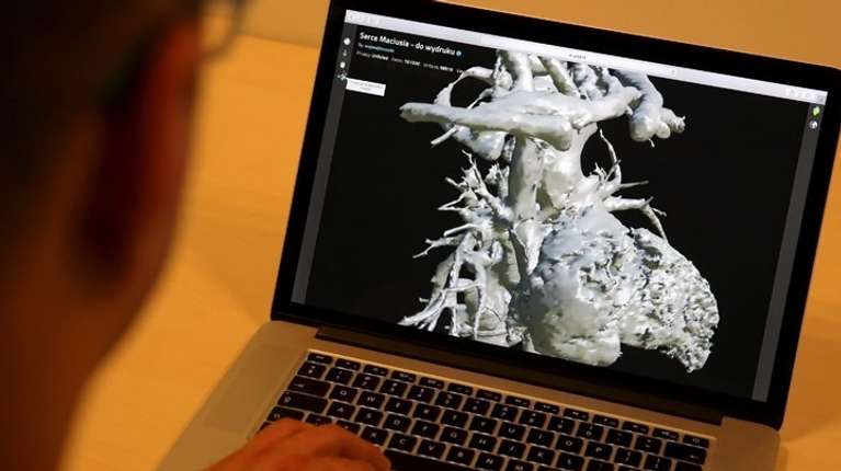 Η AI "διαβάζει" την καρδιά πριν νοσήσει -Τι αποκαλύπτουν μαστογραφία και φωτογραφίες προσώπου